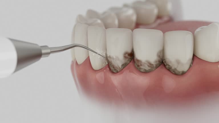 Reliable Dental contractor in La Puente, CA by Smile Center Dentistry